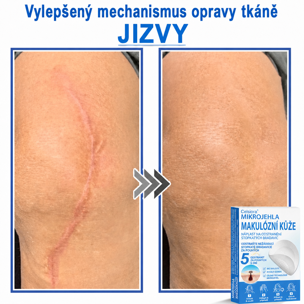 🏆Celsiora® Náplasti 2 v 1 s mikrojehličkami a hydrokoloidem | Odstraňovač vystouplých kožních výrůstků🍖🍖
