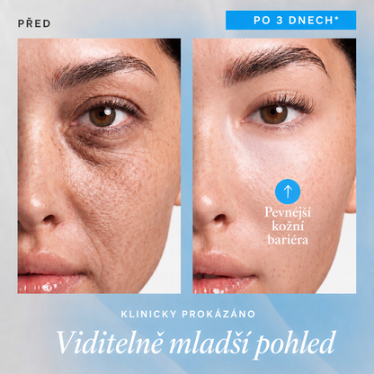 Celsiora® Botox & PDRN protivráskový shot – liftingový a zpevňující krém✨✨