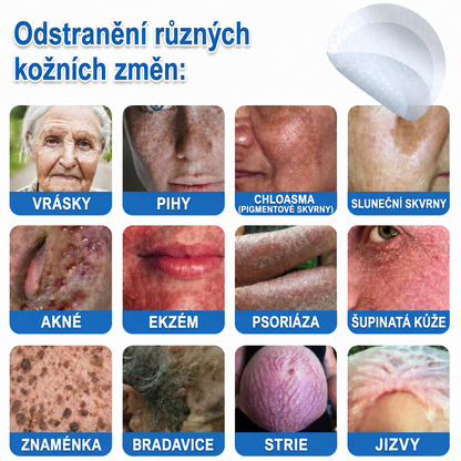 🏆Celsiora® Náplasti 2 v 1 s mikrojehličkami a hydrokoloidem | Odstraňovač vystouplých kožních výrůstků💢💢