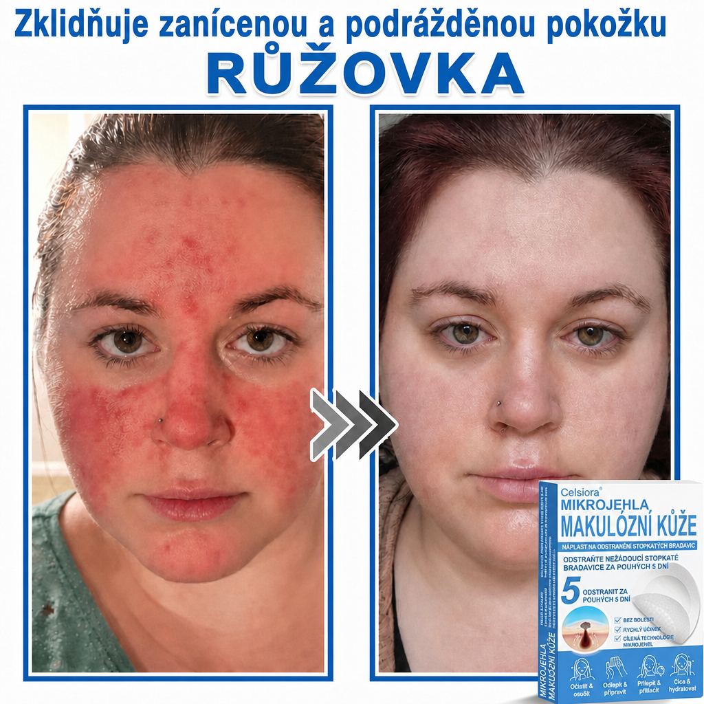 🏆Celsiora® Náplasti 2 v 1 s mikrojehličkami a hydrokoloidem | Odstraňovač vystouplých kožních výrůstků💢💢
