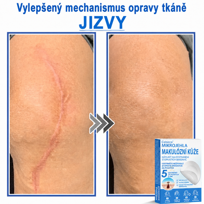 🏆Celsiora® Náplasti 2 v 1 s mikrojehličkami a hydrokoloidem | Odstraňovač vystouplých kožních výrůstků💢💢