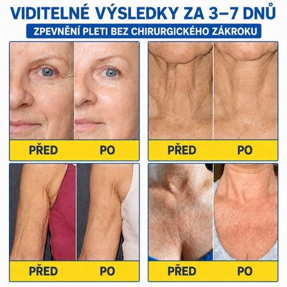 Celsiora® Botox & PDRN protivráskový shot – liftingový a zpevňující krém✨✨