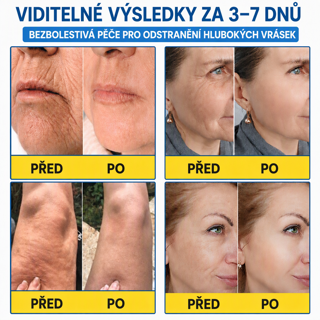 Celsiora® Botox & PDRN protivráskový shot – liftingový a zpevňující krém✨✨