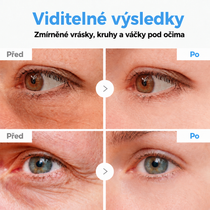 Celsiora® Botox & PDRN protivráskový shot – liftingový a zpevňující krém✨✨